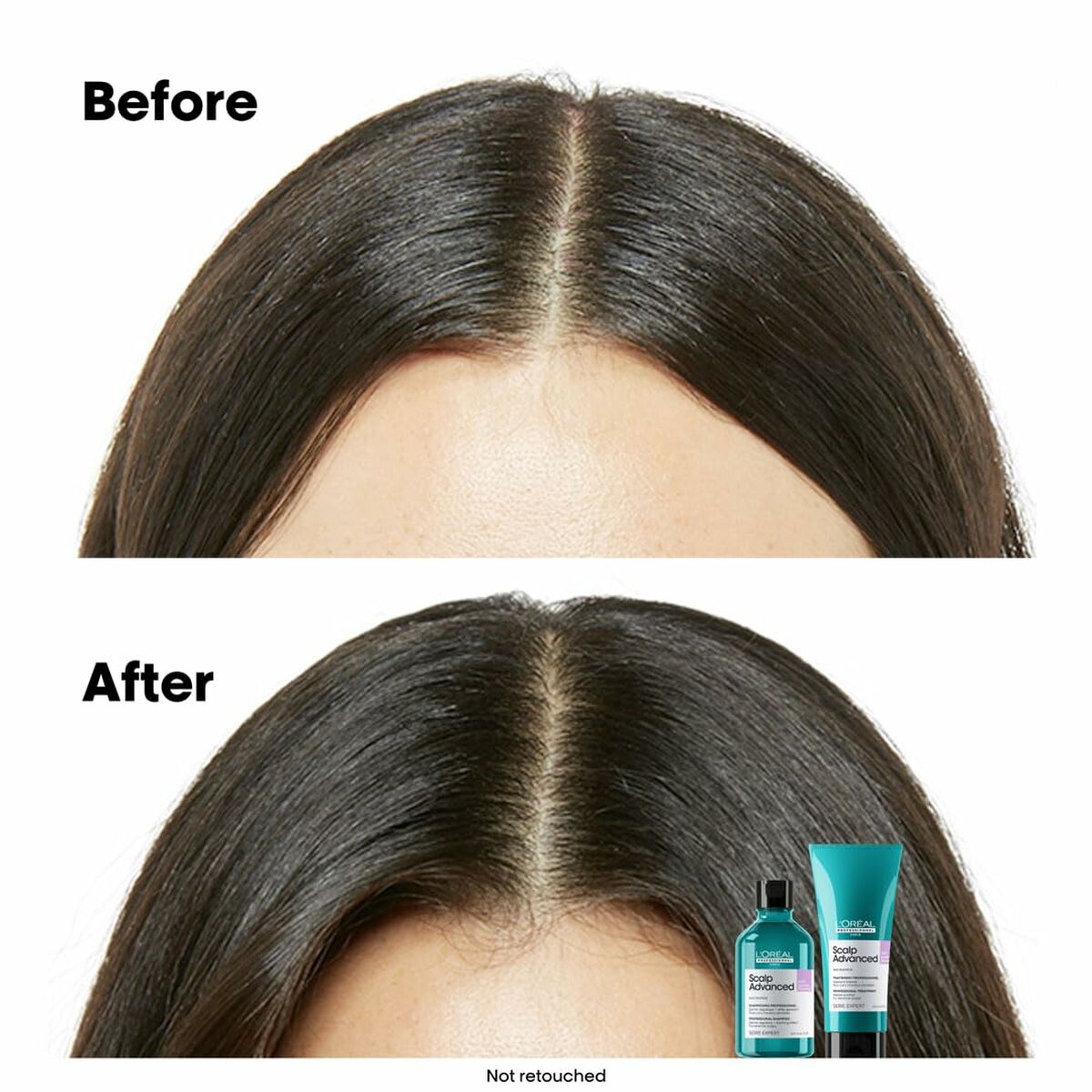 Comparative image showing hair before and after using L'Oreal hair care products, highlighting transformation results.