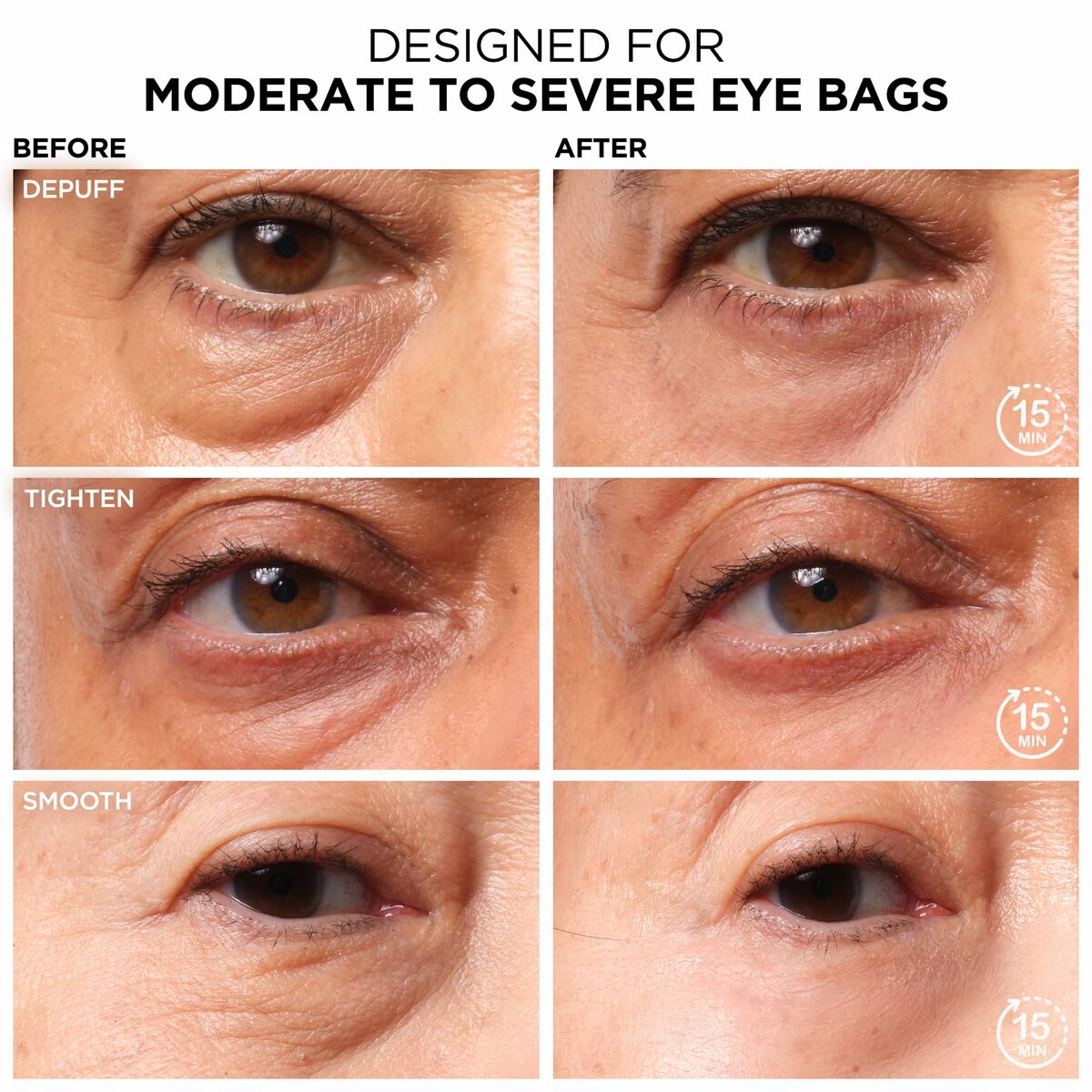 Before and after results showcasing eye cream effectiveness on moderate to severe eye bags, highlighting depuffing, tightening, and smoothing.