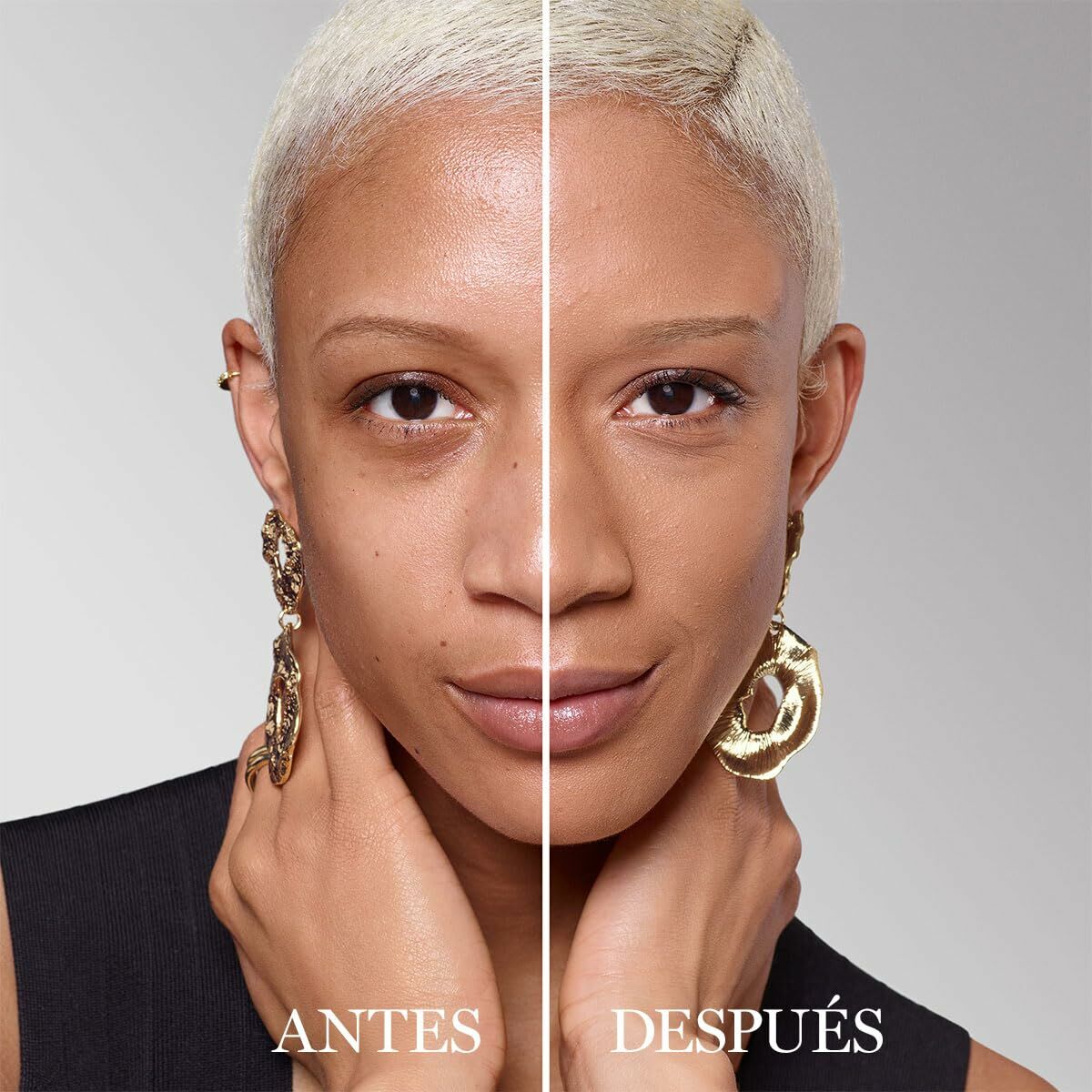 Before and after comparison of a woman's beauty transformation, highlighting skin improvements.