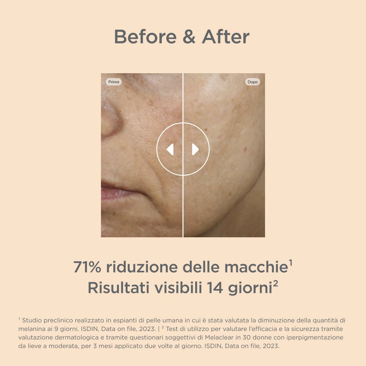 Before and after results showing a 71% reduction in skin spots after using Isdin Melaclear serum over 14 days.